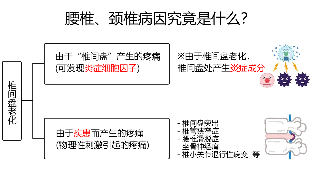 腰椎、颈椎病因究竟是什么？