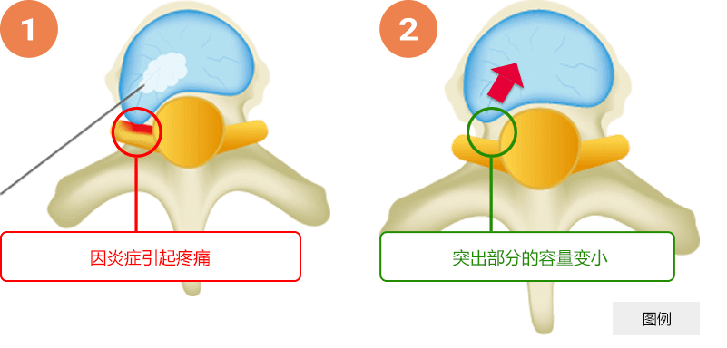 PODD法治疗图像