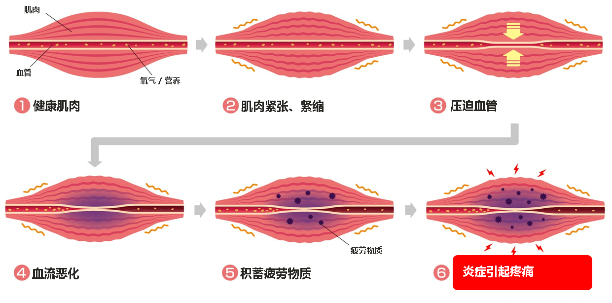 炎症の流れ