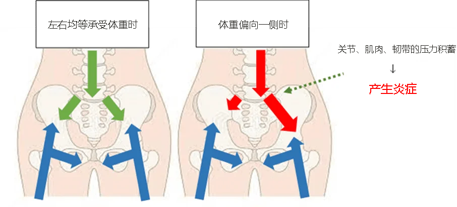 关节、肌肉和韧带压力累积，引起炎症