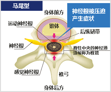 马尾图像