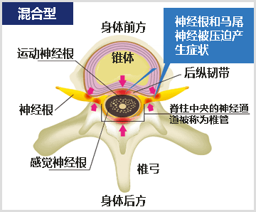 混合型图像