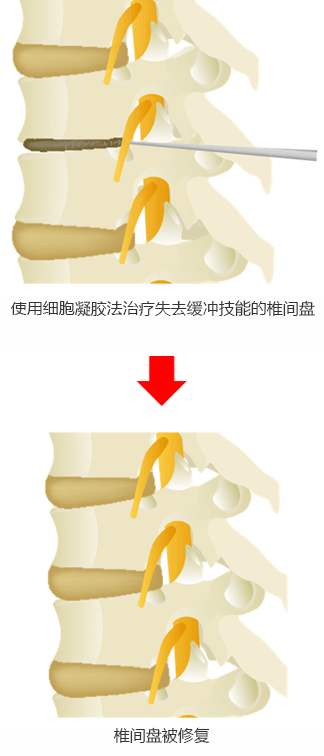 Cellgel法的治疗图像