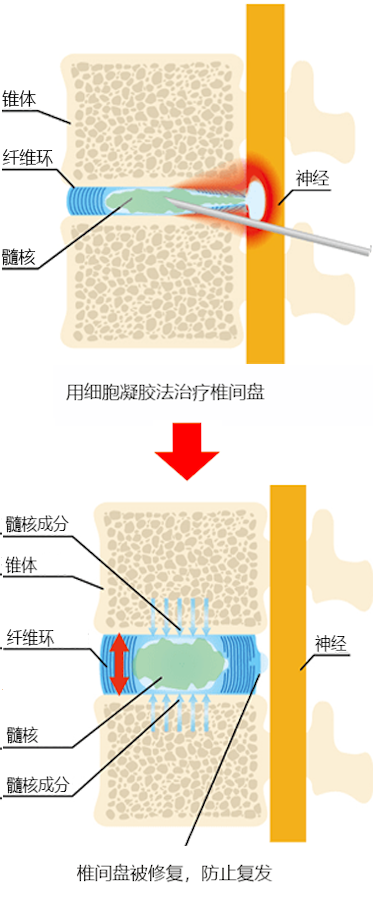 Cellgel法的治疗图像