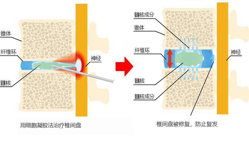 Cellgel法的治疗图像