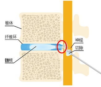 Cellgel法的治疗图像