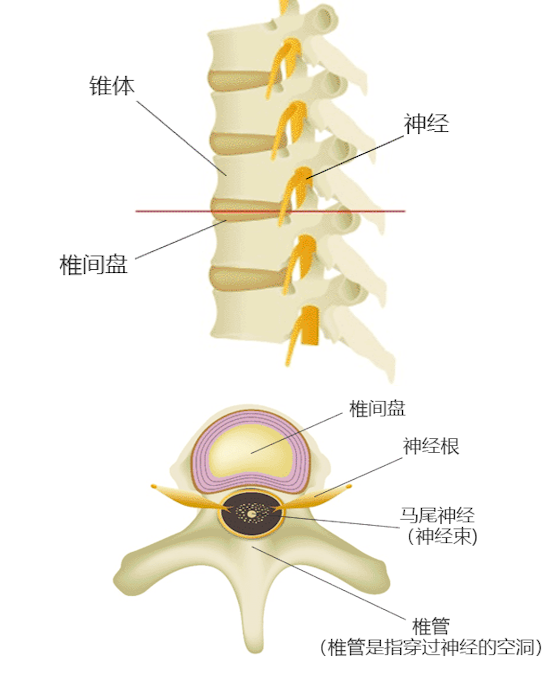 椎管狭窄的图像