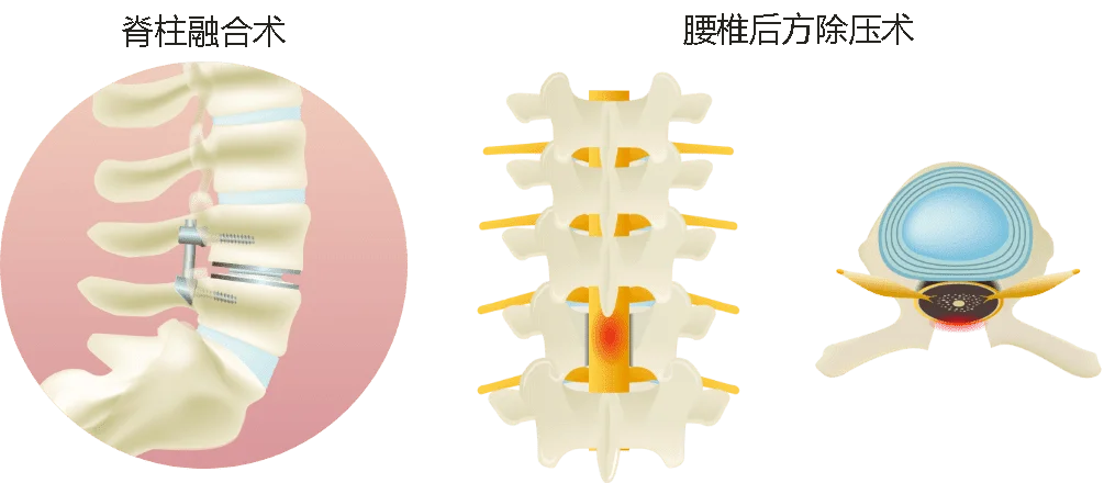 従来の治療イメージ