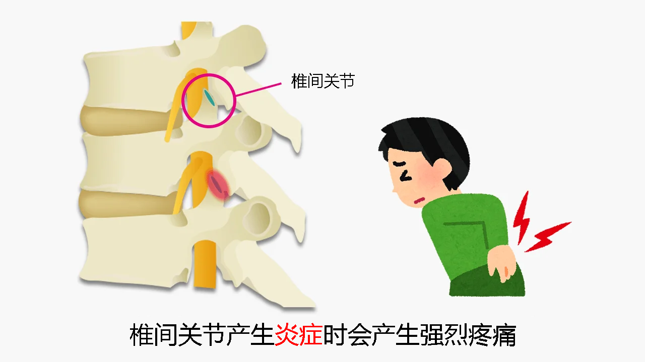 小关节炎症引起的剧烈疼痛